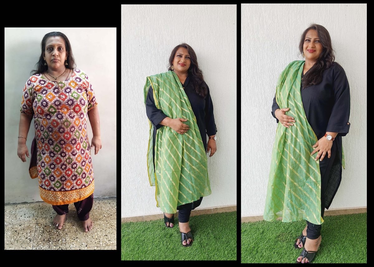 Bhavna before and after