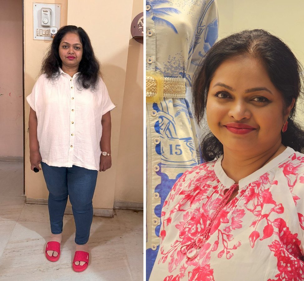 Dr Prachi before and after