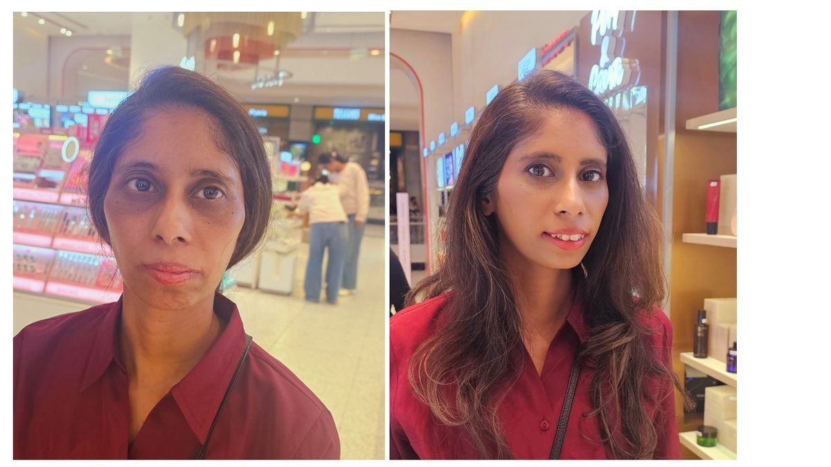 Manasi before and after